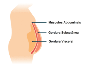 Obesidade e inflamação no corpo